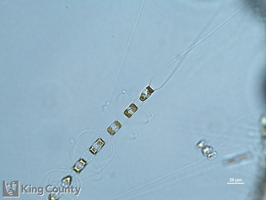 Photo of Chaetoceros laciniosus